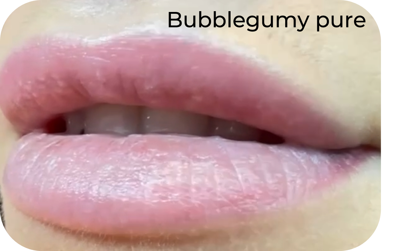 Bubblegum